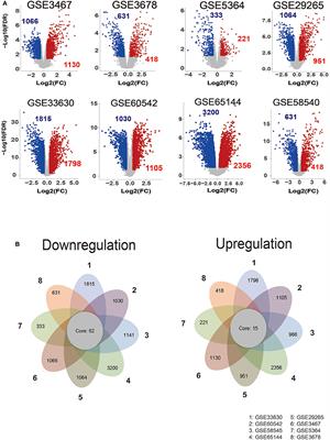 Identification of a Recurrence Signature and Validation of Cell Infiltration Level of Thyroid Cancer Microenvironment